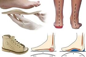 Orthopedic shoes for valgus in children