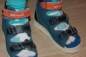 wearing sandals for valgus in children