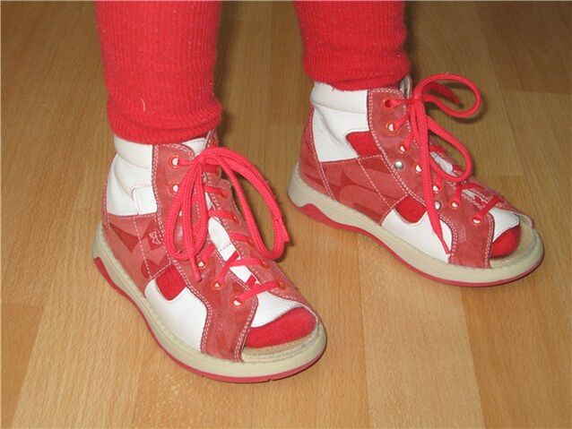 Shoes for children with twisted big toes