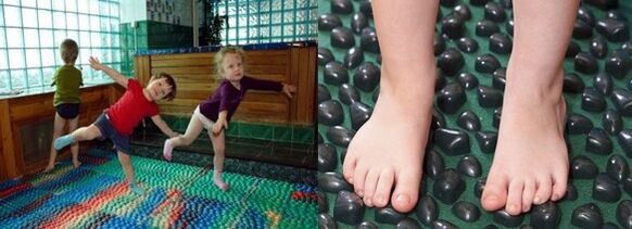 Exercise for Valgus deformation