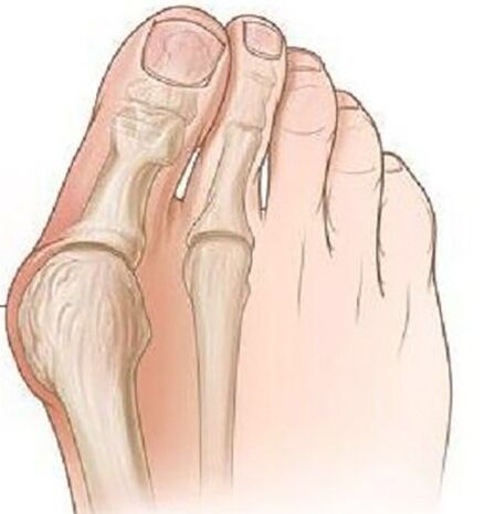 The thumb group